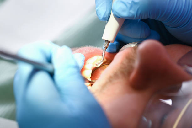 Best Emergency Orthodontic Services in Bertsch Oceanview, CA