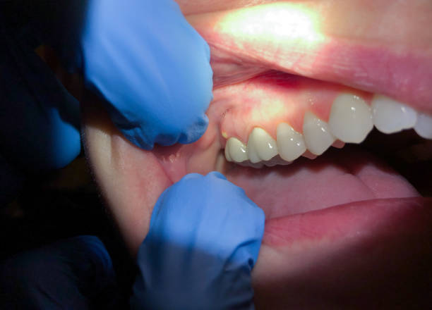 Best After-Hours Dental Trauma Care in Bertsch Oceanview, CA